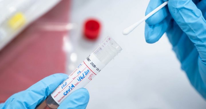 KRASI PIEAUDZIS COVID-19 INFICĒTO SKAITS TUKUMA NOVADĀ