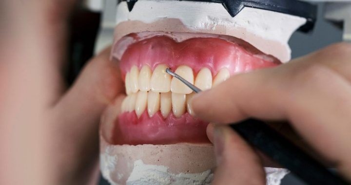 Seši zobu protēžu veidi, kas izskatās kā dabīgie zobi